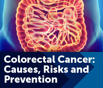 Image for Colorectal Cancer: Causes, Risks and Prevention