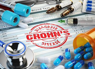 Crohns disease graphic