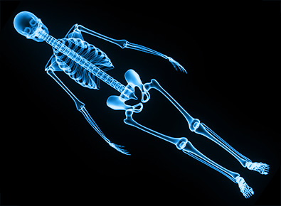 Ortho x-ray