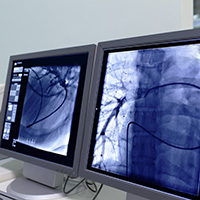 cardiac diagnostics