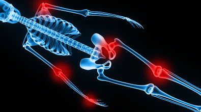 Skeletal rendering with joints highlighted
