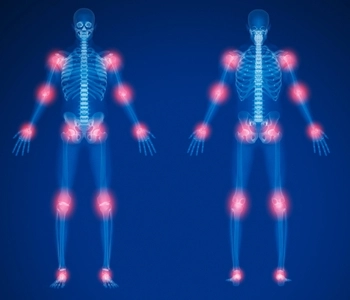 Common Orthopedic Conditions You Should Know
