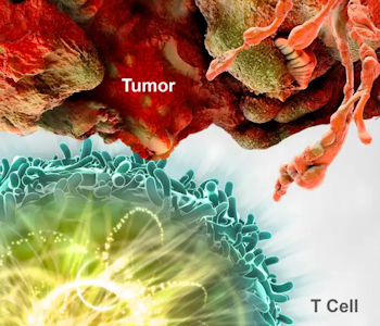 Immunotherapy Helps Patients’ Bodies Battle Cancer